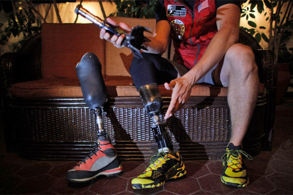 In this Thursday, April 16, 2015 photo, former U.S. Marine Charlie Linville holds his prosthesis during an interview with the Associated Press in Kathmandu, Nepal. (AP Photo/Niranjan Shrestha)