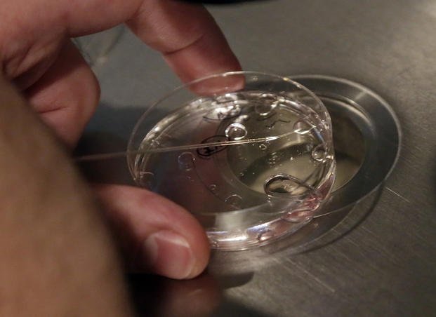 Embryologist Rick Slifkin demonstrates fertilization techniques on a nonviable embryo at Reproductive Medicine Associates of New York