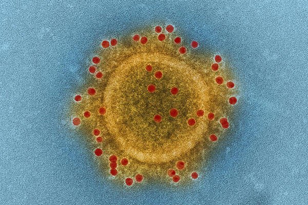 This image shows Middle East respiratory syndrome coronavirus particle envelope proteins immunolabeled with rabbit HCoV-EMC/2012 primary antibody and goat anti-rabbit 10-nanometer gold particles. (NIAID photo)